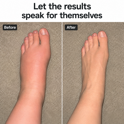 Ankle Compression Socks for Swelling & Aching Feet